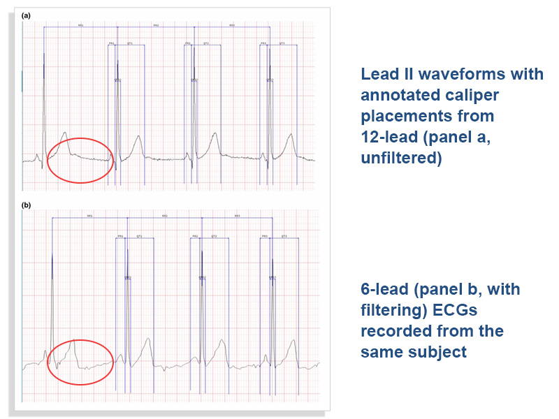 FAQs12Lead Pocket ECG Machine Wellue